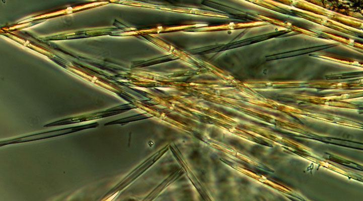 Marine Algae (Pseudo-nitzschia) which produces demoic acid